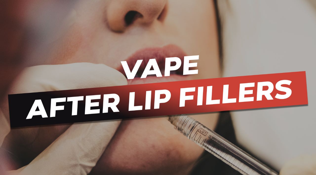 Can I Vape After Lip Fillers? Vapor Shop Direct Can I Vape After Lip Fillers? Vapor Shop Direct